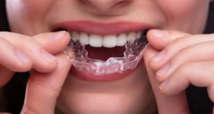 Does Insurance Cover Invisalign